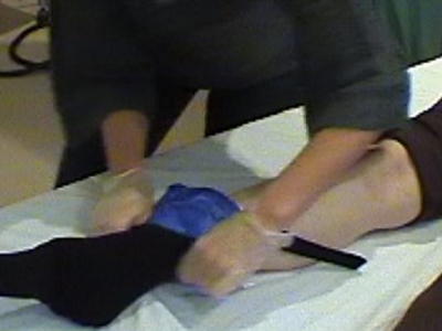 En person med gips på benet på en säng.